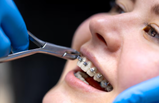 Orthodontist Terdekat